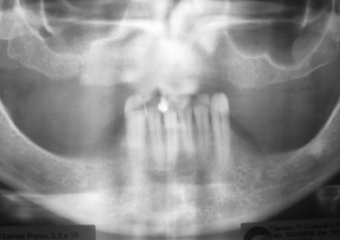 Raio X inicial - Clínica Cliniface