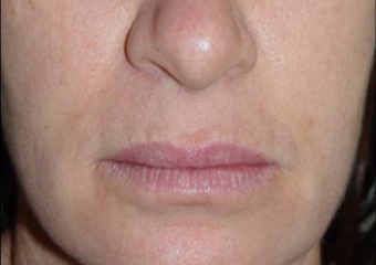 Imagens iniciais - Clínica Cliniface