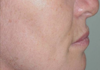  - Clínica Cliniface