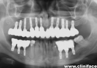 Raio X final - Clínica Cliniface