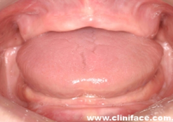 Imagem intra oral inicial - Clínica Cliniface