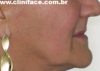 Imagem perfil inicial - Clínica Cliniface