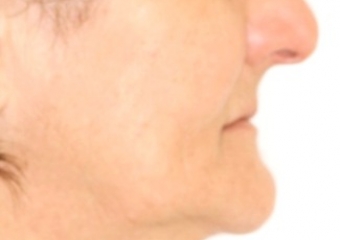 Perfil inicial - Clínica Cliniface