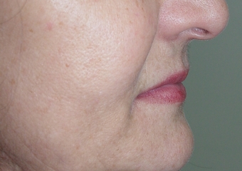 Perfil final - Clínica Cliniface