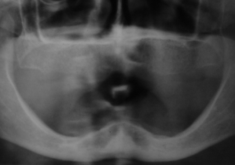 Raio X inicial - Clínica Cliniface