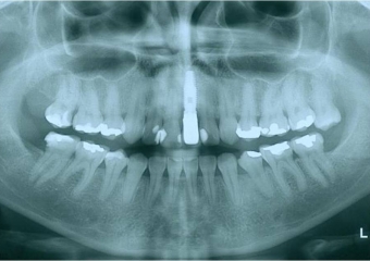 Raio X final - Clínica Cliniface