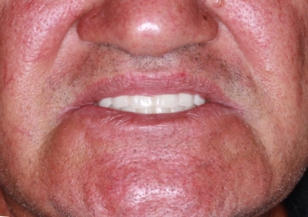 Sorriso Final, em 2016 - Clínica Cliniface