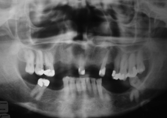 Rx Inicial - Clínica Cliniface