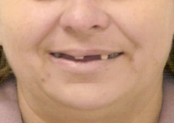 Sorriso Inicial - Clínica Cliniface