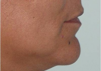 Imagem final - Clínica Cliniface