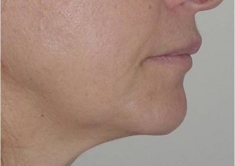 Perfil final - Clínica Cliniface