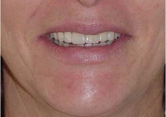 Imagem final - Clínica Cliniface