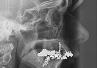 Telerradiografia inicial - Clínica Cliniface