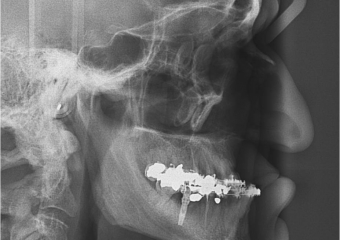 Telerradiografia inicial - Clínica Cliniface