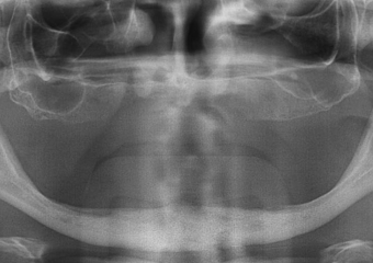 Raio X inicial - Clínica Cliniface