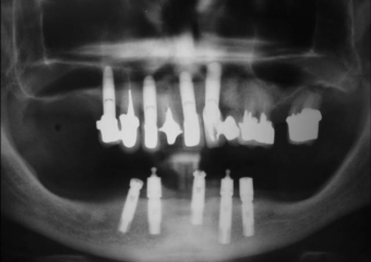  - Clínica Cliniface