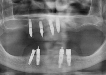  - Clínica Cliniface