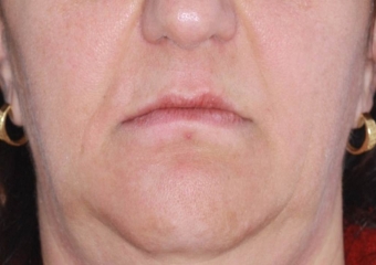 Imagem inicial - Clínica Cliniface