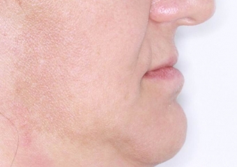 Perfil inicial - Clínica Cliniface