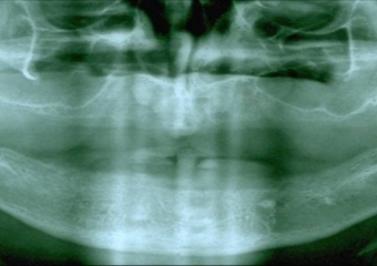 Raio X inicial - Clínica Cliniface