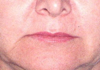 Imagem inicial - Clínica Cliniface