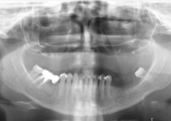 Raio X inicial - Clínica Cliniface