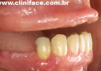  - Clínica Cliniface