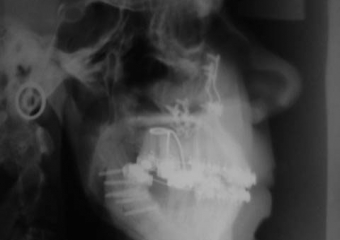 Telerradiografia final - Clínica Cliniface