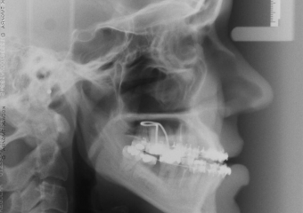 Telerradiografia inicial  - Clínica Cliniface