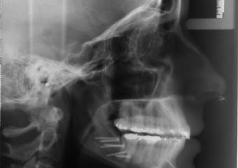 Teleradiografia final - Clínica Cliniface