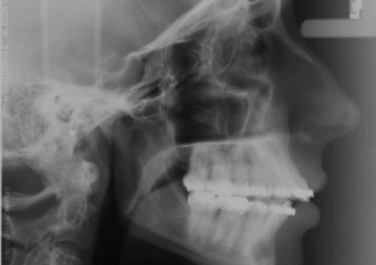 Teleradiografia inicial     - Clínica Cliniface