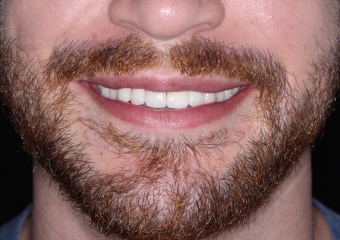 Sorriso Final, Novembro de 2015 - Clínica Cliniface