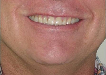 Sorriso final - Clínica Cliniface