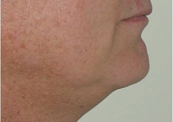 Perfil final - Clínica Cliniface