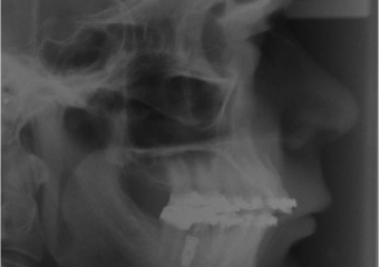 Telerradiografia inicial - Clínica Cliniface