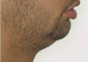 Perfil inicial - Clínica Cliniface