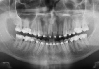 Raio x inicial - Clínica Cliniface