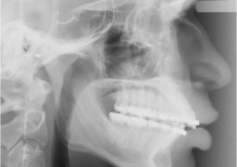 Telerradiografia inicial - Clínica Cliniface