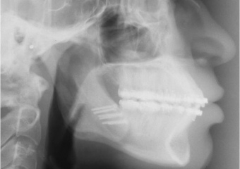Telerradiografia após cirurgia - Clínica Cliniface