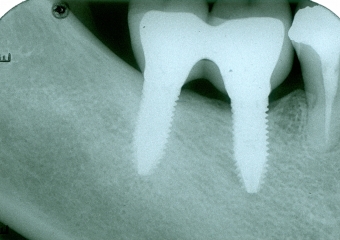 Raio X final - Clínica Cliniface