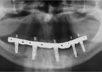 Raio X final - Clínica Cliniface