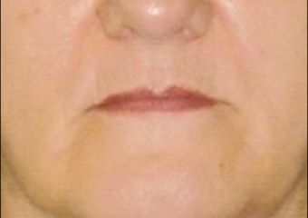 Imagens iniciais - Clínica Cliniface