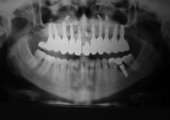 Raio X final - Clínica Cliniface
