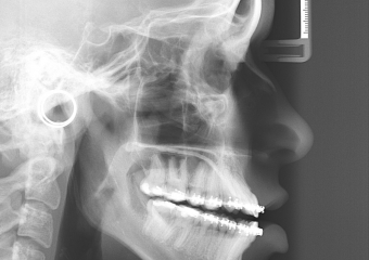 Telerradiografia inicial - Clínica Cliniface